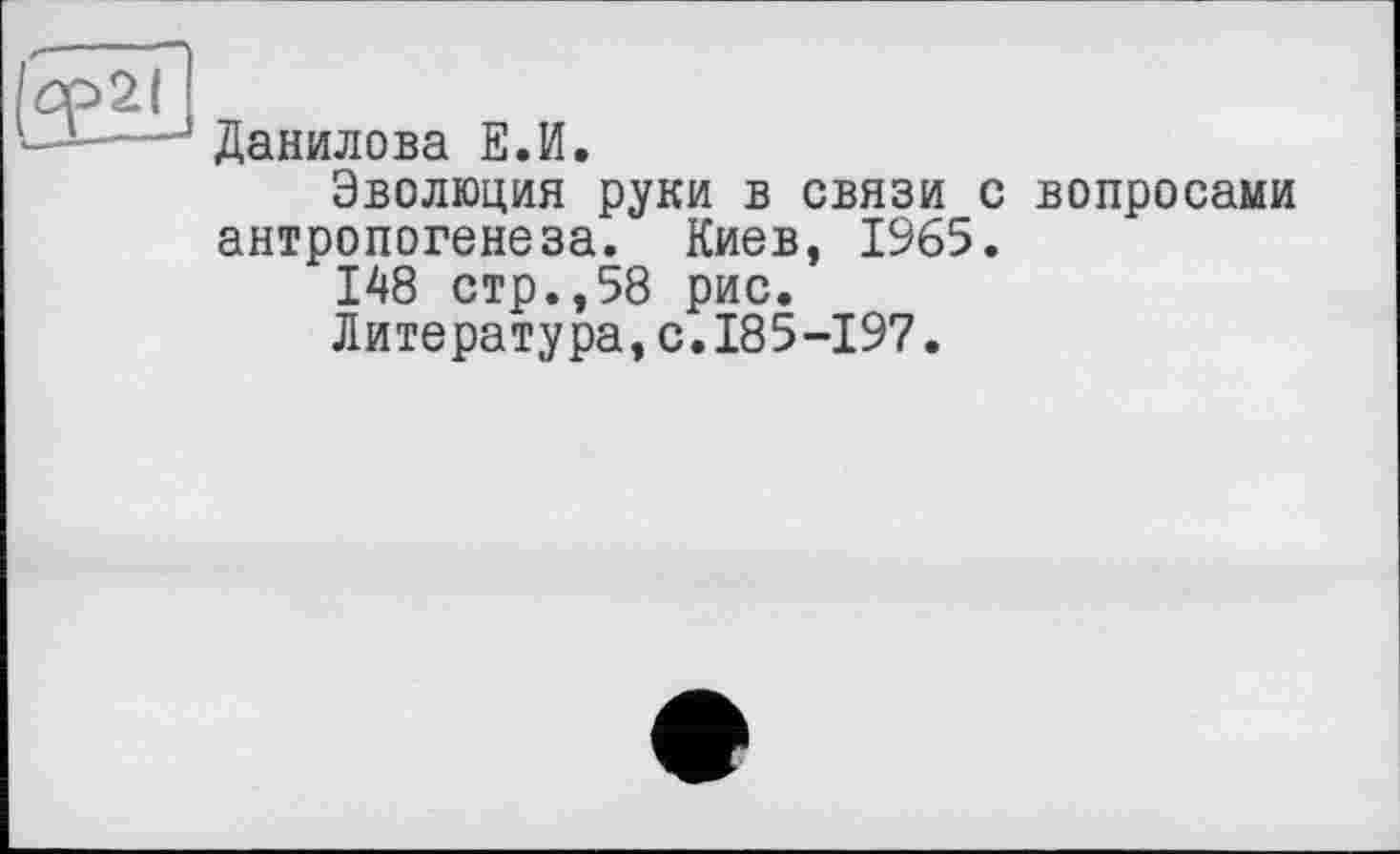 ﻿Данилова ЕЛ.
Эволюция руки в связи с вопросами антропогенеза. Киев, 1965.
148 стр.,58 рис.
Литература,с.185-197.